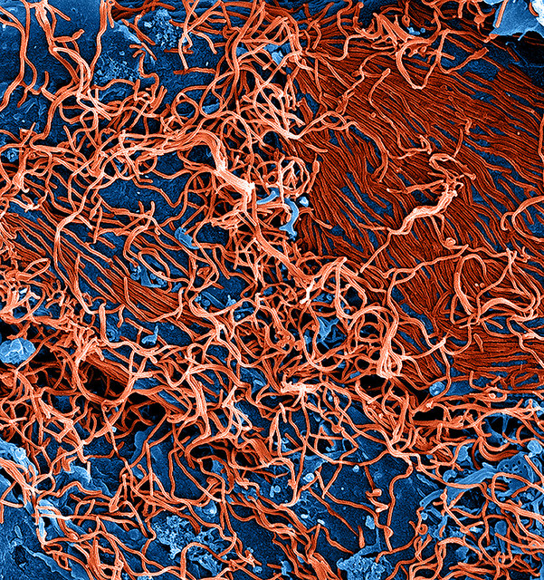 Ebola Image